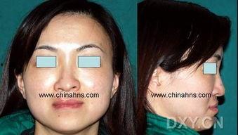 成人清理鼻孔视频播放网站,实用技巧与注意事项