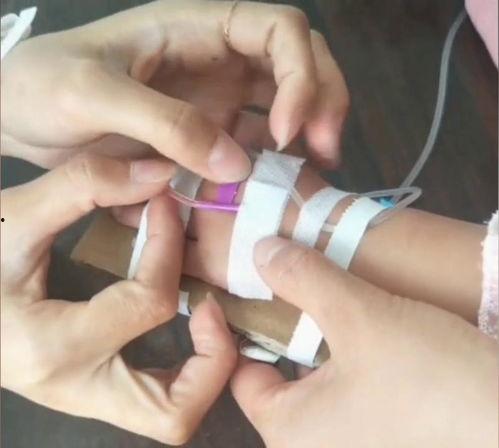 成人脖子扎留置针视频,成人颈部穿刺技巧解析